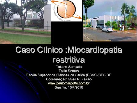 Caso Clínico :Miocardiopatia restritiva Tatiane Sampaio Talita Soares Escola Superior de Ciências da Saúde (ESCS)/SES/DF Coordenação: Sueli R. Falcão.