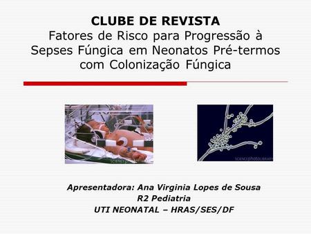 Apresentadora: Ana Virginia Lopes de Sousa UTI NEONATAL – HRAS/SES/DF