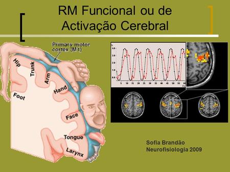 RM Funcional ou de Activação Cerebral Sofia Brandão