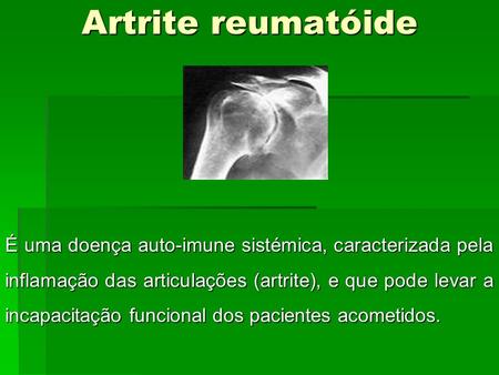 Artrite reumatóide É uma doença auto-imune sistémica, caracterizada pela inflamação das articulações (artrite), e que pode levar a incapacitação funcional.