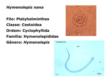 Hymenolepis nana Filo: Platyhelminthes Classe: Cestoidea