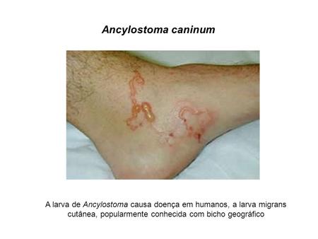 Ancylostoma caninum A larva de Ancylostoma causa doença em humanos, a larva migrans cutânea, popularmente conhecida com bicho geográfico.