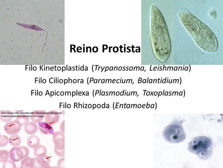 Reino Protista Filo Kinetoplastida (Trypanossoma, Leishmania)