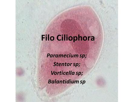 Paramecium sp; Stentor sp; Vorticella sp; Balantidium sp