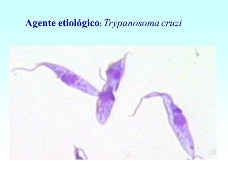 Agente etiológico: Trypanosoma cruzi