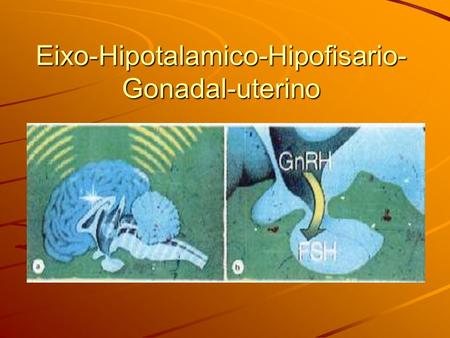 Eixo-Hipotalamico-Hipofisario-Gonadal-uterino