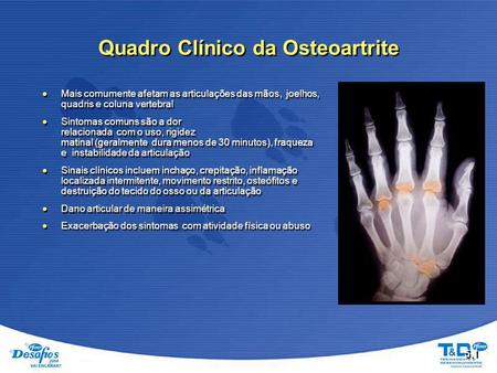 Quadro Clínico da Osteoartrite