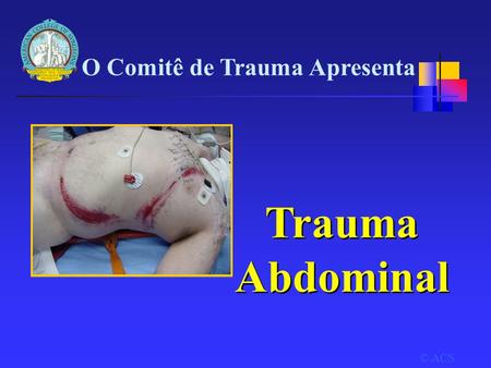 Trauma Abdominal O Comitê de Trauma Apresenta © ACS Title slide
