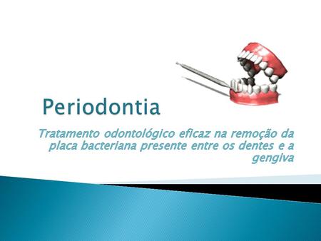 Periodontia Tratamento odontológico eficaz na remoção da placa bacteriana presente entre os dentes e a gengiva.