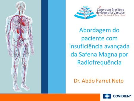 Abordagem do paciente com insuficiência avançada da Safena Magna por Radiofrequência Dr. Abdo Farret Neto.