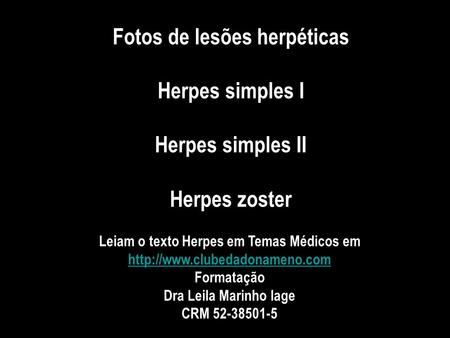 Fotos de lesões herpéticas Herpes simples I Herpes simples II