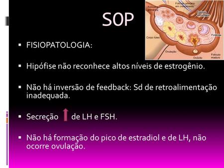 SOP FISIOPATOLOGIA: Hipófise não reconhece altos níveis de estrogênio.