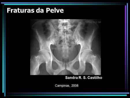 Fraturas da Pelve Sandra R. S. Castilho Campinas, 2008.