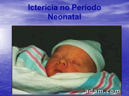 Icterícia no Período Neonatal