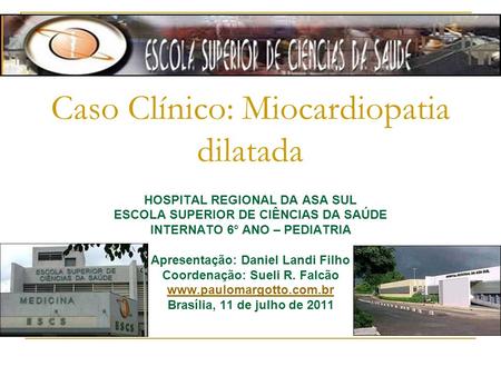 Caso Clínico: Miocardiopatia dilatada