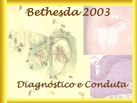 Bethesda 2003 Diagnóstico e Conduta.