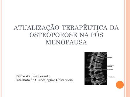ATUALIZAÇÃO TERAPÊUTICA DA OSTEOPOROSE NA PÓS MENOPAUSA
