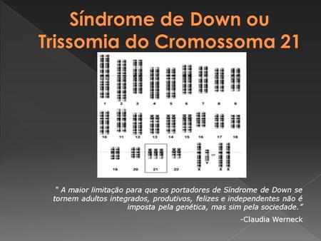 Síndrome de Down ou Trissomia do Cromossoma 21