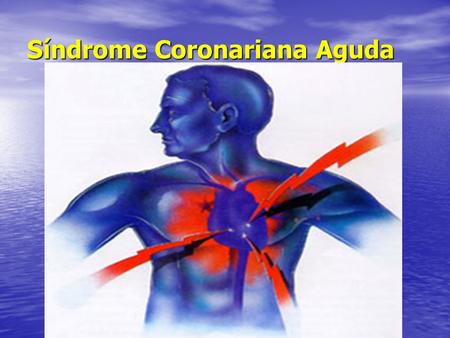 Síndrome Coronariana Aguda