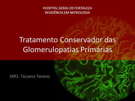 HOSPITAL GERAL DE FORTALEZA RESIDÊNCIA EM NEFROLOGIA Tratamento Conservador das Glomerulopatias Primárias MR1: Tacyano Tavares.