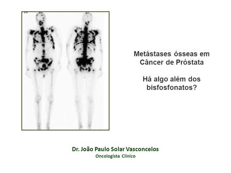 Dr. João Paulo Solar Vasconcelos Oncologista Clínico Metástases ósseas em Câncer de Próstata Há algo além dos bisfosfonatos?