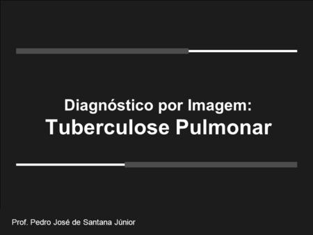 Ucg Diagnóstico por Imagem: Tuberculose Pulmonar Prof. Pedro José de Santana Júnior.