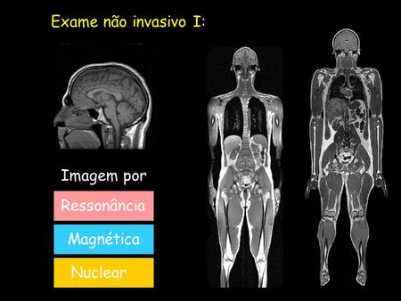 Exame não invasivo I: Imagem por Ressonância Magnética Nuclear.