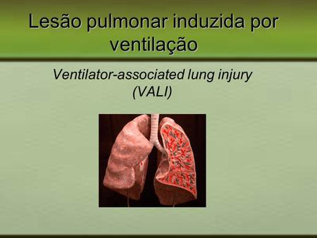Lesão pulmonar induzida por ventilação