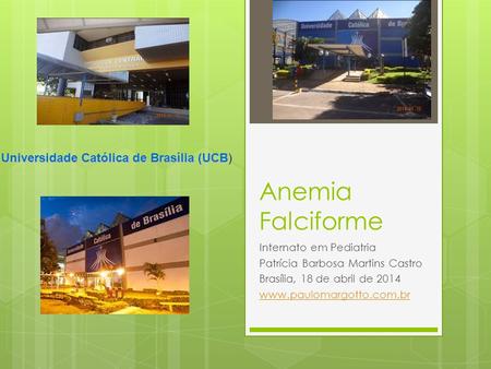 Anemia Falciforme Universidade Católica de Brasília (UCB)