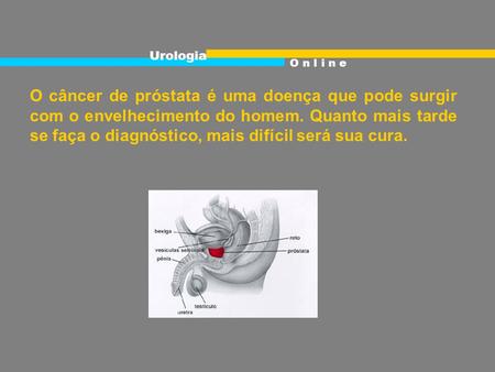 Urologia O n l i n e O câncer de próstata é uma doença que pode surgir com o envelhecimento do homem. Quanto mais tarde se faça o diagnóstico, mais.