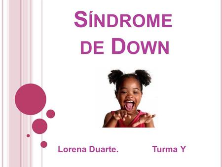 Síndrome de Down Lorena Duarte. Turma Y.
