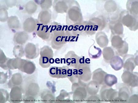 Trypanosoma cruzi Doença de Chagas