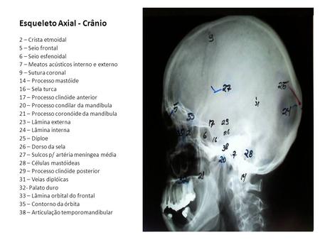 Esqueleto Axial - Crânio