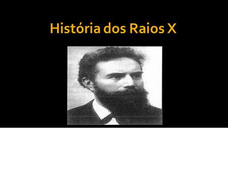 História dos Raios X 08 de novembro de 1895: Descoberta dos Raios X Pelo Professor de física teórica Wilhelm Conrad Röntgen.