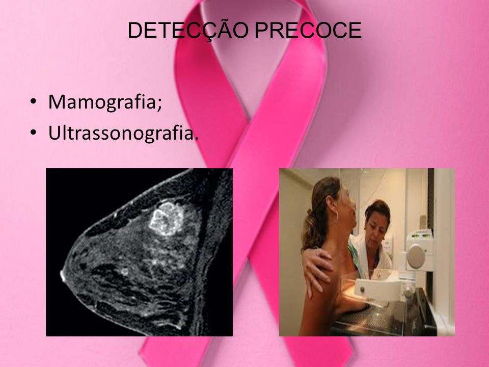 DETECÇÃO PRECOCE Mamografia; Ultrassonografia.