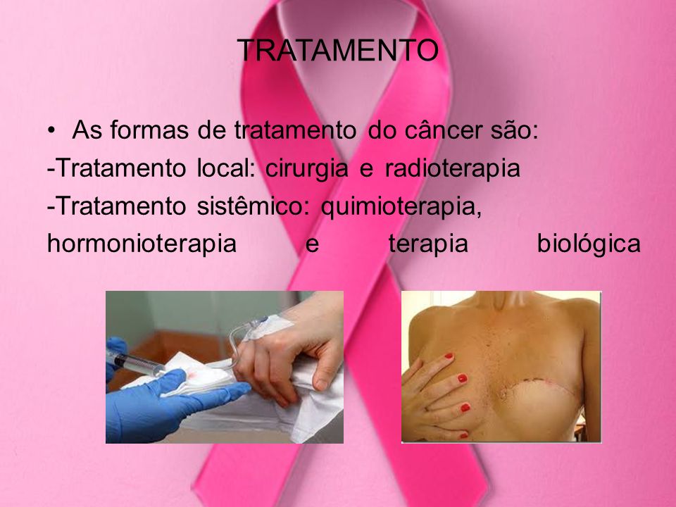 TRATAMENTO As formas de tratamento do câncer são: