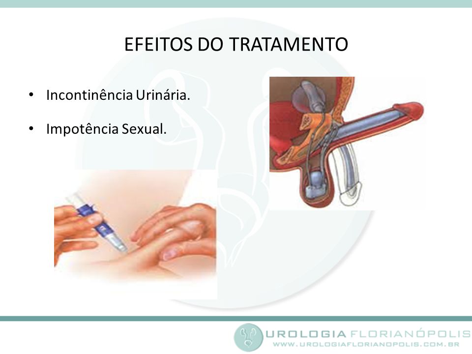 EFEITOS DO TRATAMENTO Incontinência Urinária. Impotência Sexual.