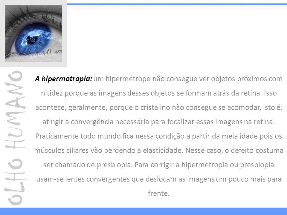 A hipermotropia: um hipermétrope não consegue ver objetos próximos com nitidez porque as imagens desses objetos se formam atrás da retina.