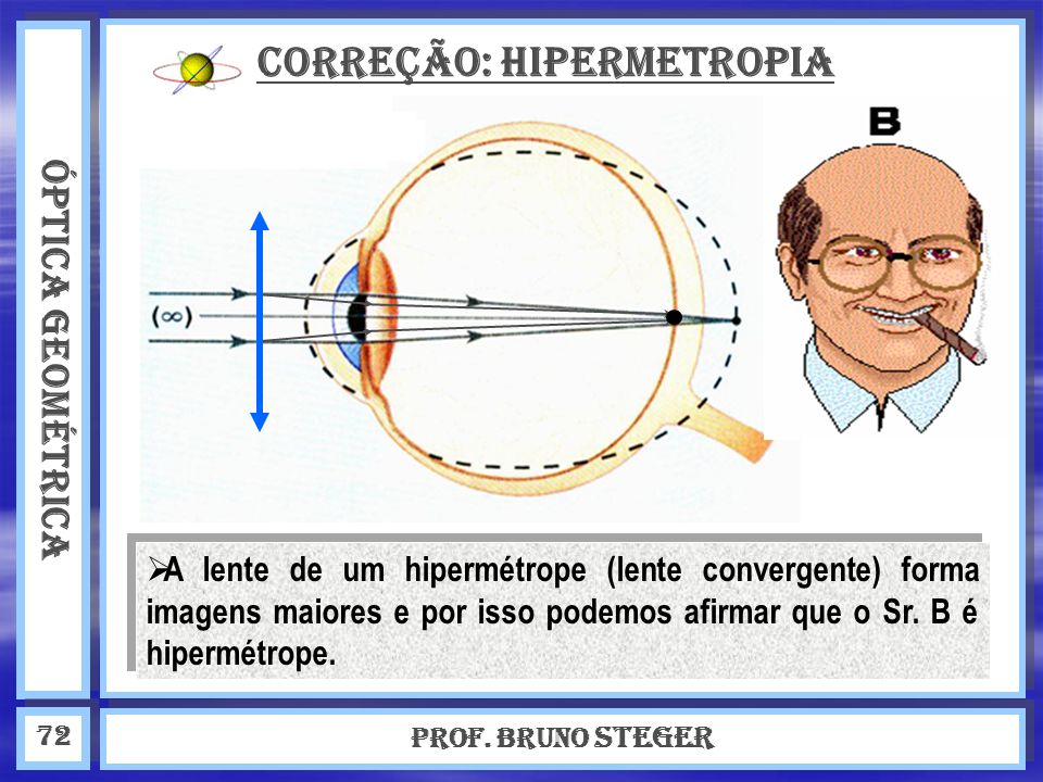 Correção: Hipermetropia