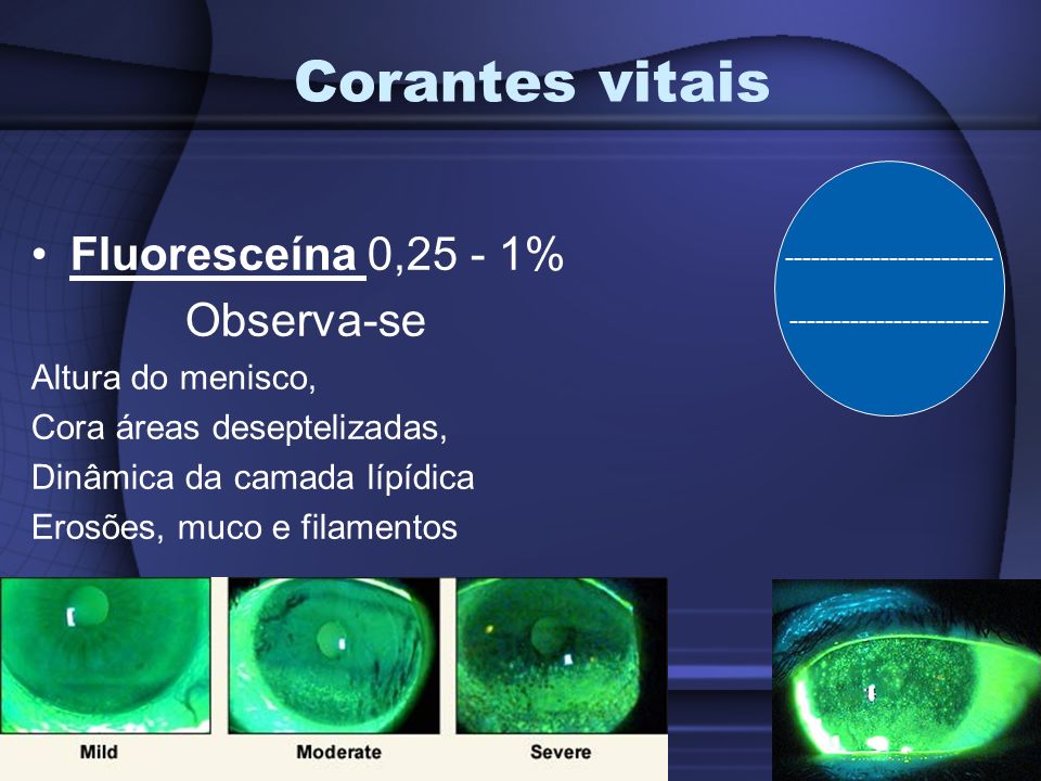 Corantes vitais Fluoresceína 0,25 - 1% Observa-se Altura do menisco,