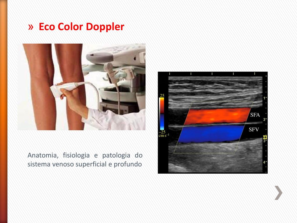 Eco Color Doppler Anatomia, fisiologia e patologia do sistema venoso superficial e profundo