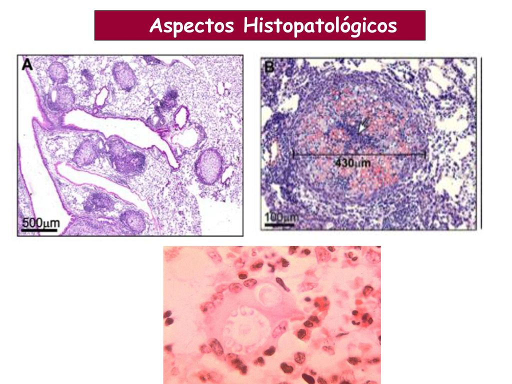 Aspectos Histopatológicos