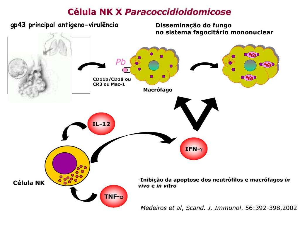 Célula NK X Paracoccidioidomicose