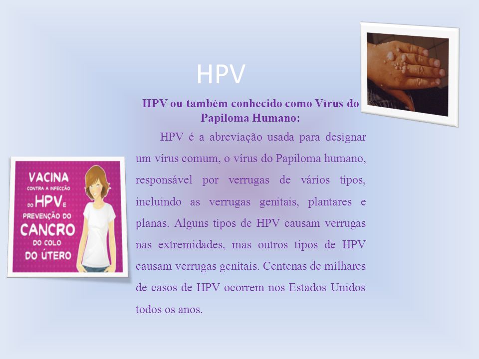 HPV ou também conhecido como Vírus do Papiloma Humano: