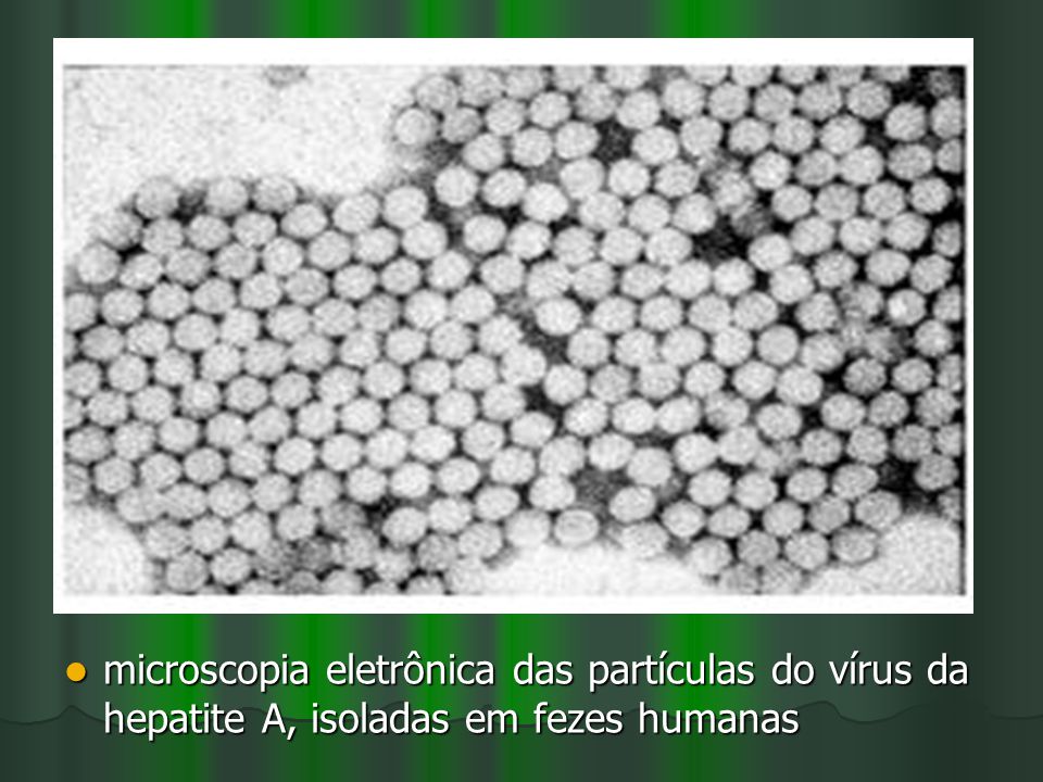 microscopia eletrônica das partículas do vírus da hepatite A, isoladas em fezes humanas