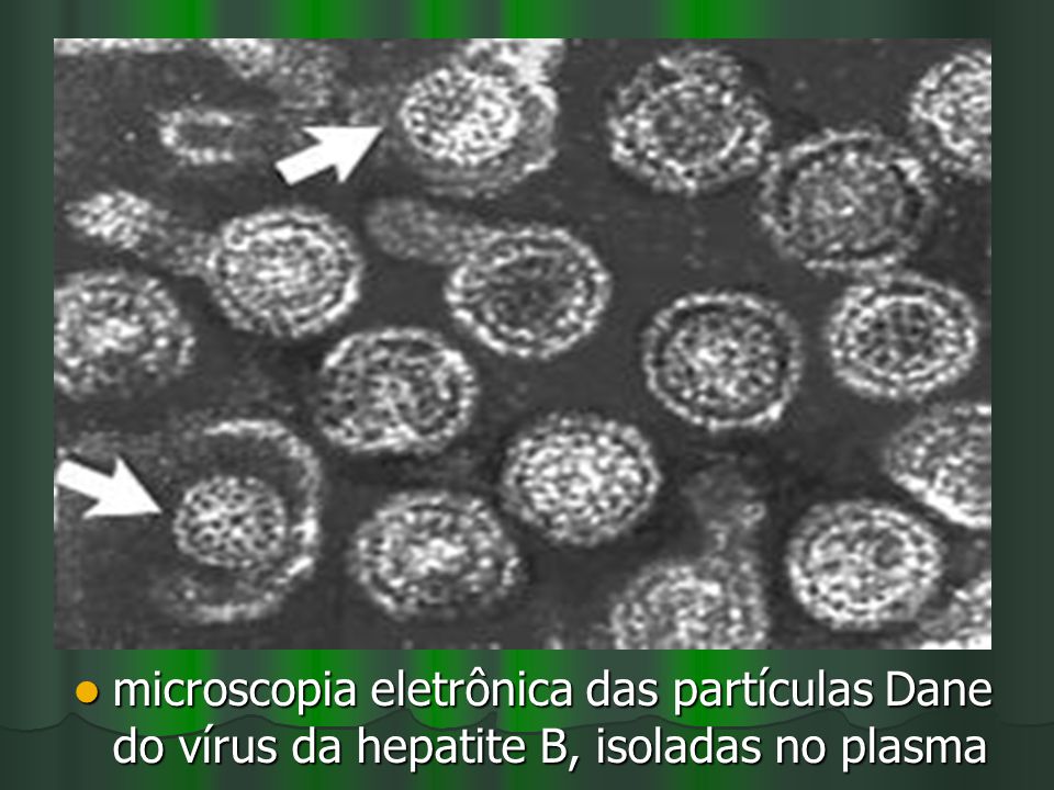 microscopia eletrônica das partículas Dane do vírus da hepatite B, isoladas no plasma