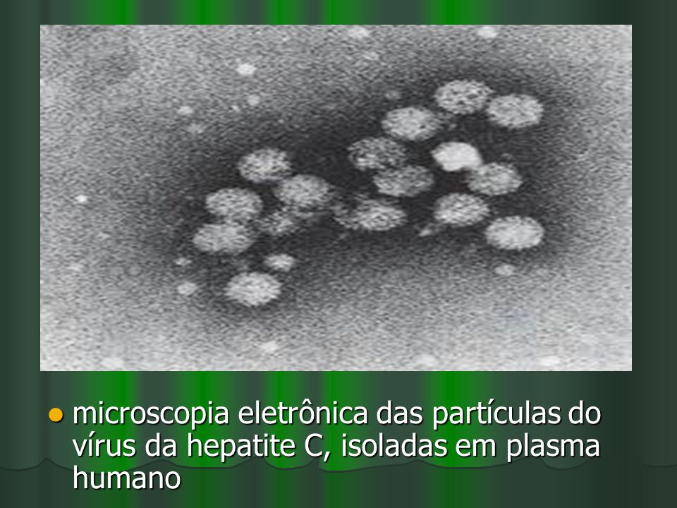 microscopia eletrônica das partículas do vírus da hepatite C, isoladas em plasma humano