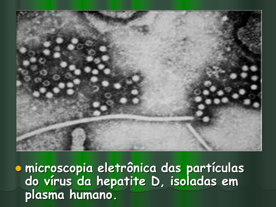 microscopia eletrônica das partículas do vírus da hepatite D, isoladas em plasma humano.