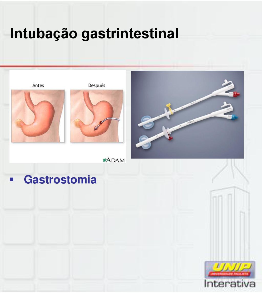 Intubação gastrintestinal