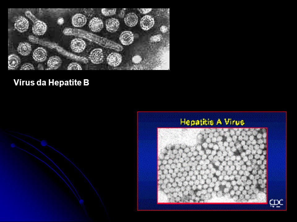 Vírus da Hepatite B